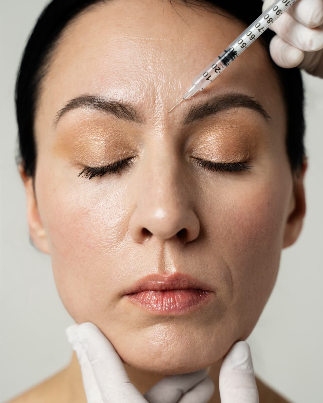 Wrinkle relaxing injections at The One Clinic Leicester