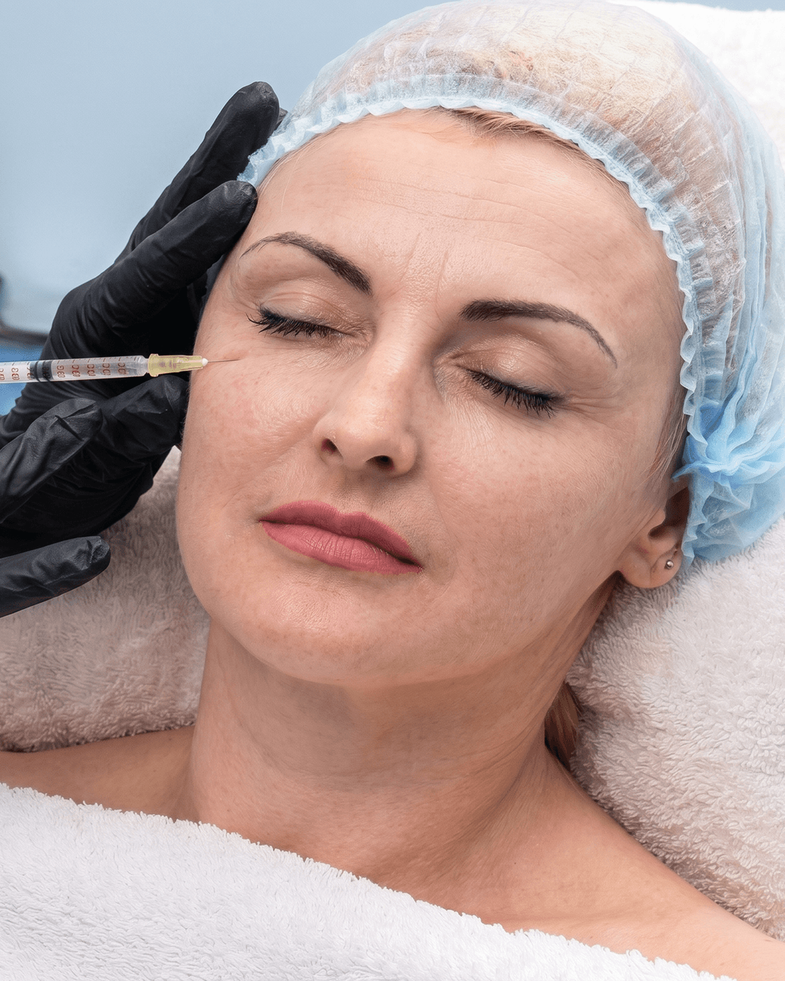 NCTF 135 HA skin booster treatment at The One Clinic Leicester