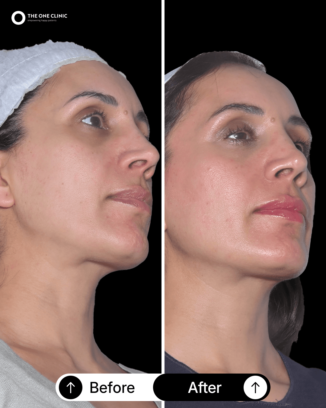Patient before and after results