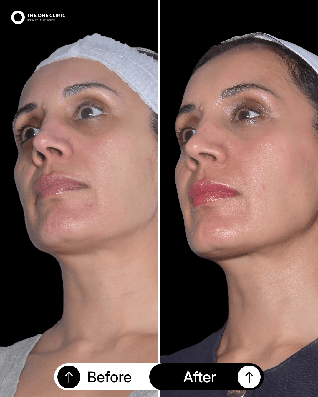 Patient before and after results