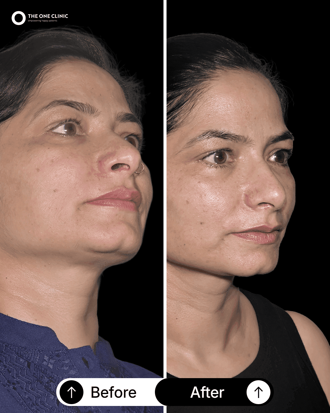 Patient before and after results