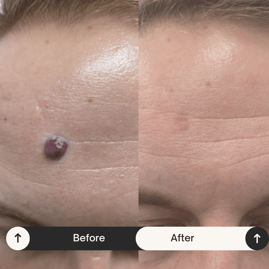 Before and after treatment result 3