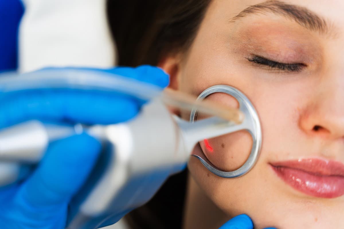 CO2 Laser Resurfacing: Everything You Need to Know About