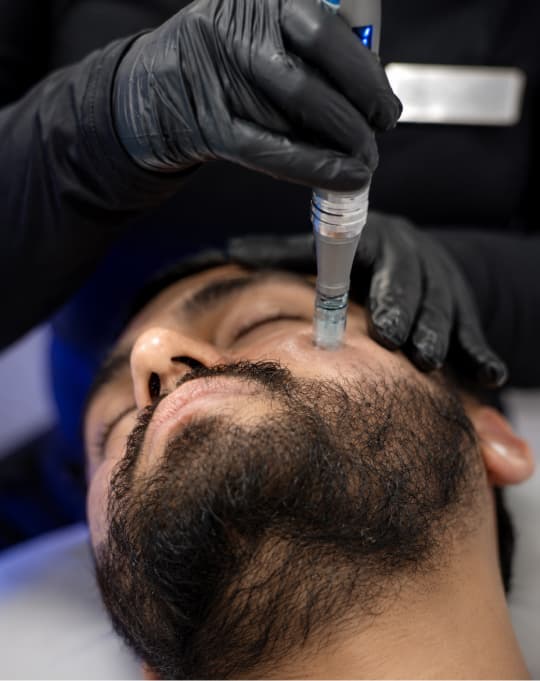 Exosome therapy treatment at The One Clinic Leicester