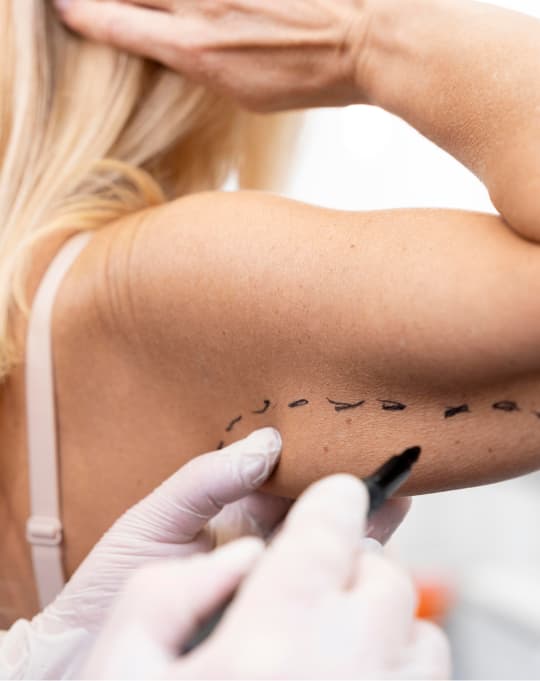 Liposuction surgical consultation at The One Clinic Leicester