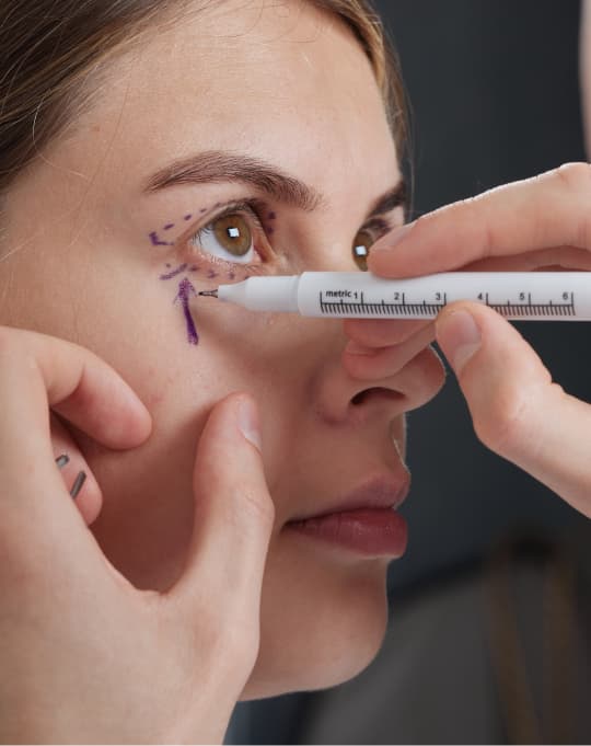 Non-surgical blepharoplasty at The One Clinic Leicester