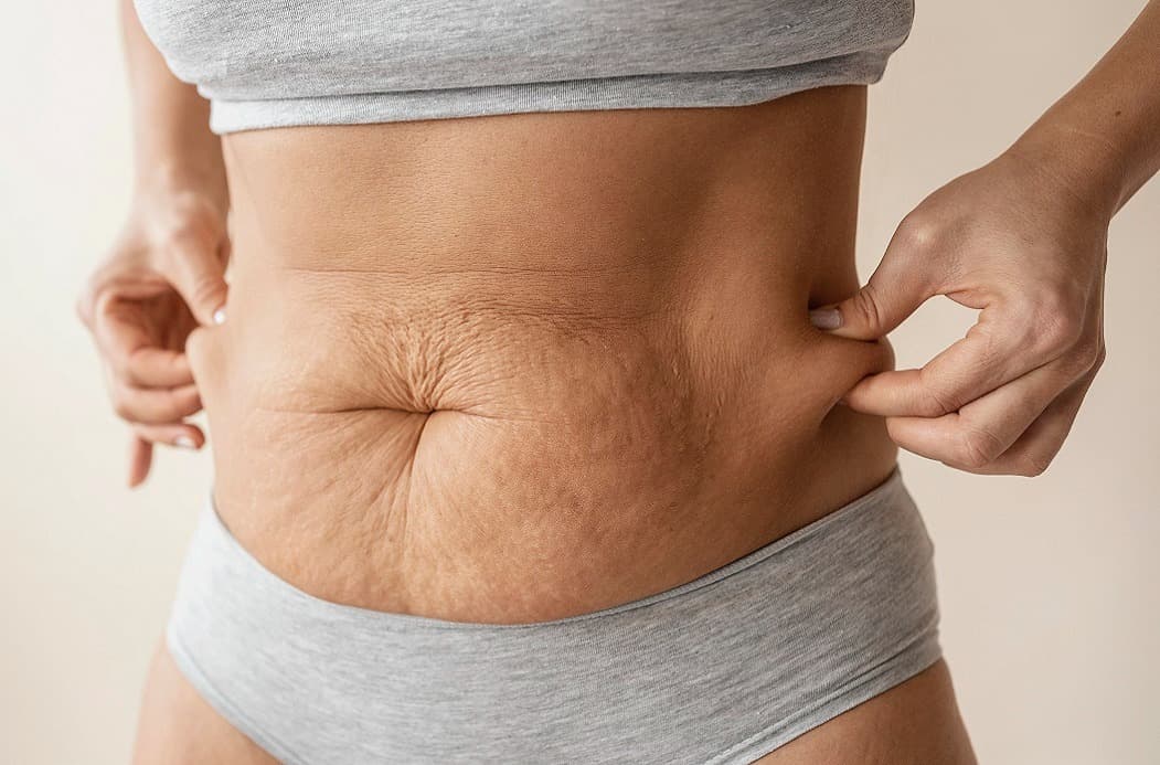 How To Get Rid Of Loose Skin? A Guide To Firm Skin